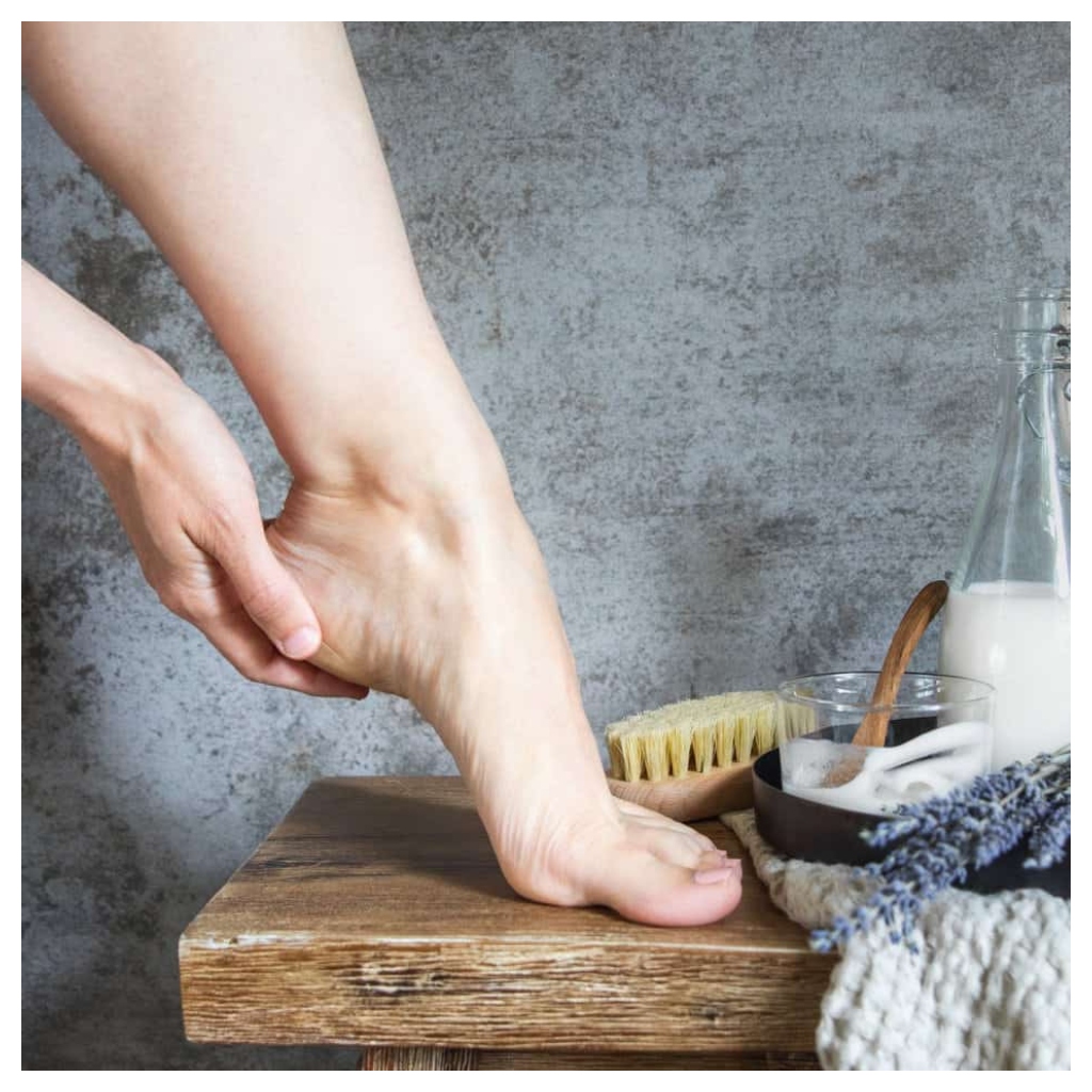 Cracked Heel Remedies