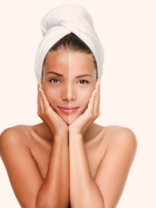 homemade face pack for tanning removal