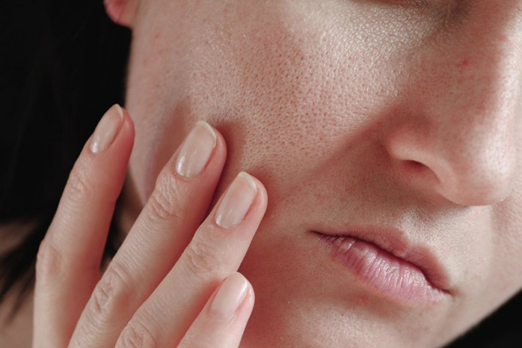 Drinking Water Really Help Dry Skin.