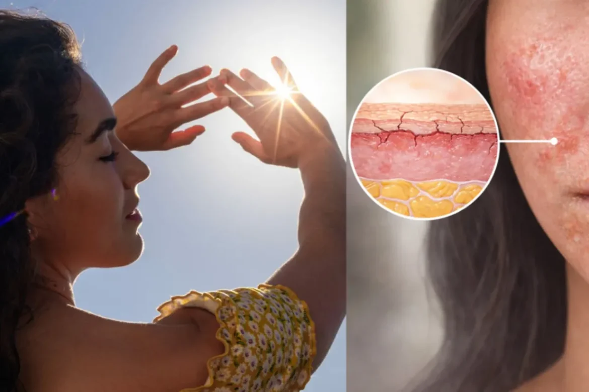 UV Rays and Skin Cancer